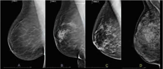 breast tissue gallery